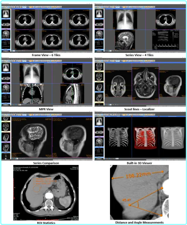 [Image: ME18OBGD_o.png]