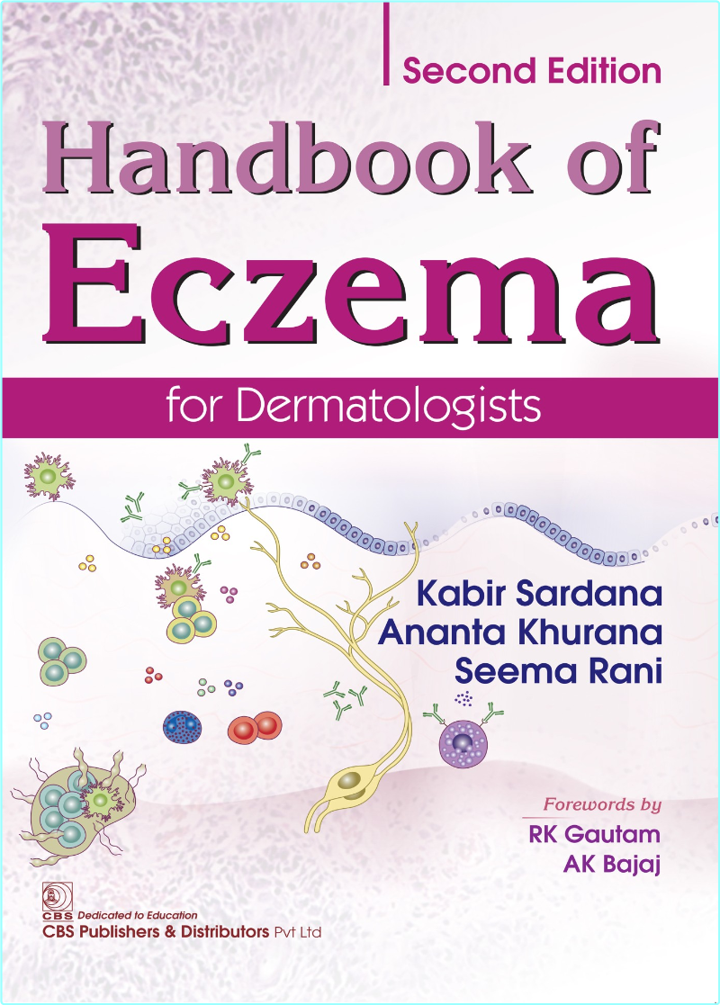 Handbook Of Eczema For Dermatologist 2nd Edition (dineshchandra) Handbook Of Eczema For Dermatologist 2nd Edition (dineshchandra)