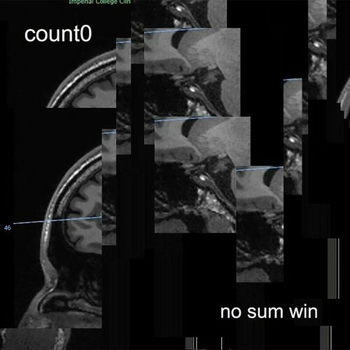  Count0 - no sum win (2023) 
