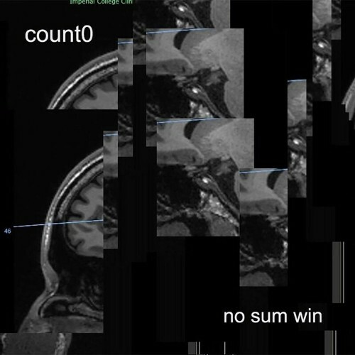 VA - Count0 - no sum win (2023) (MP3)