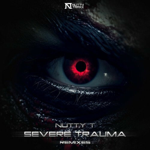  Nutty T - Severe Trauma (Remixes) (2025) 