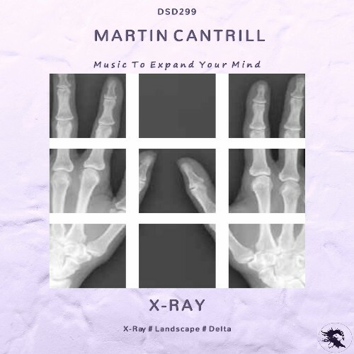  Martin Cantrill - X-Ray (2025) 