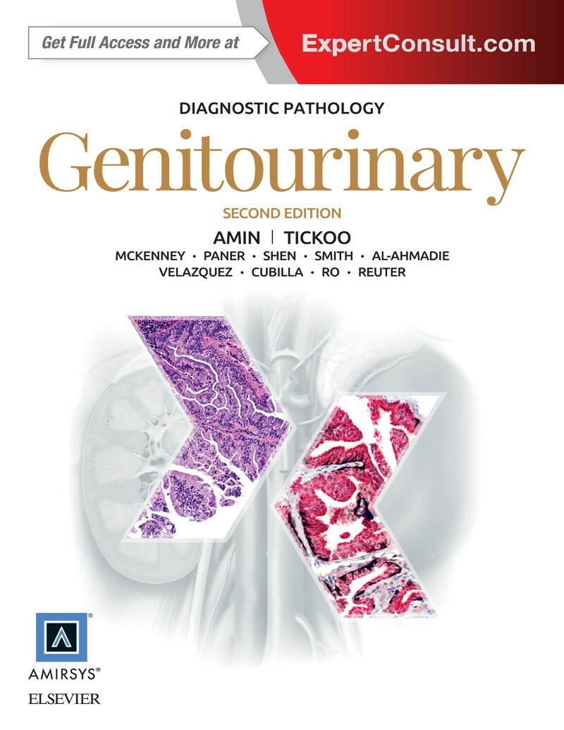 [Kép: ME1B1PX8_o.jpg]