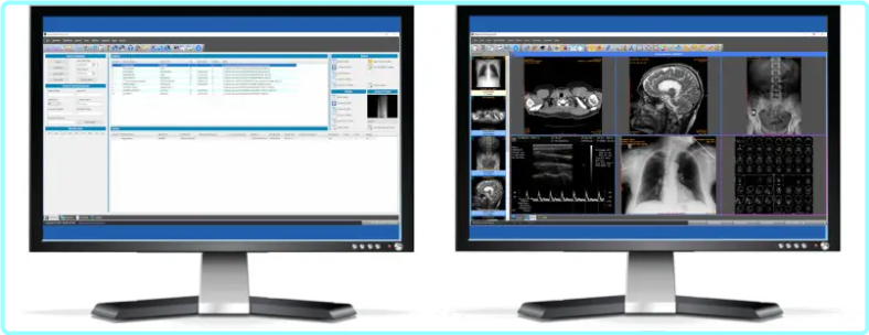 [Kép: ME18OBGG_o.png]