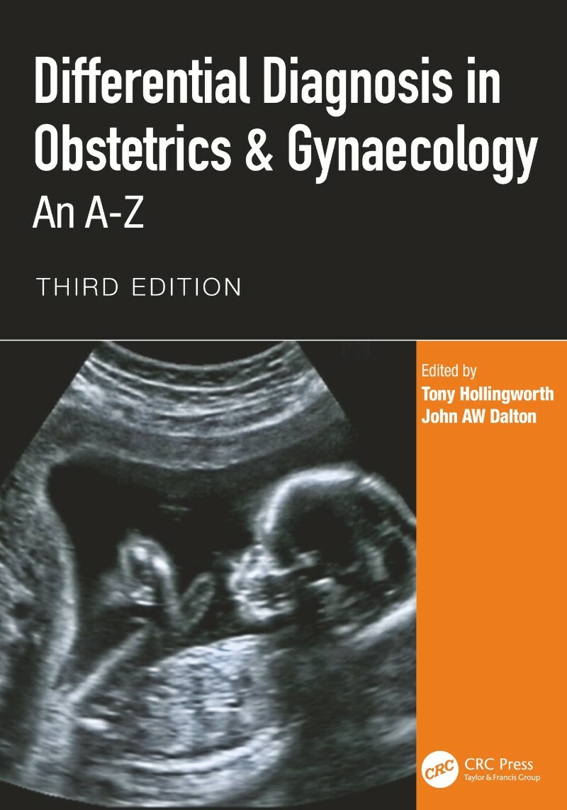 [Kép: ME1977BJ_o.jpg]