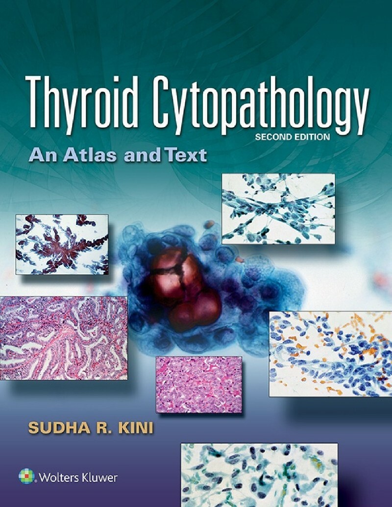 Thyroid Cytopathology An Atlas And Text 2nd Edition (Kini, Sudha R.;)
