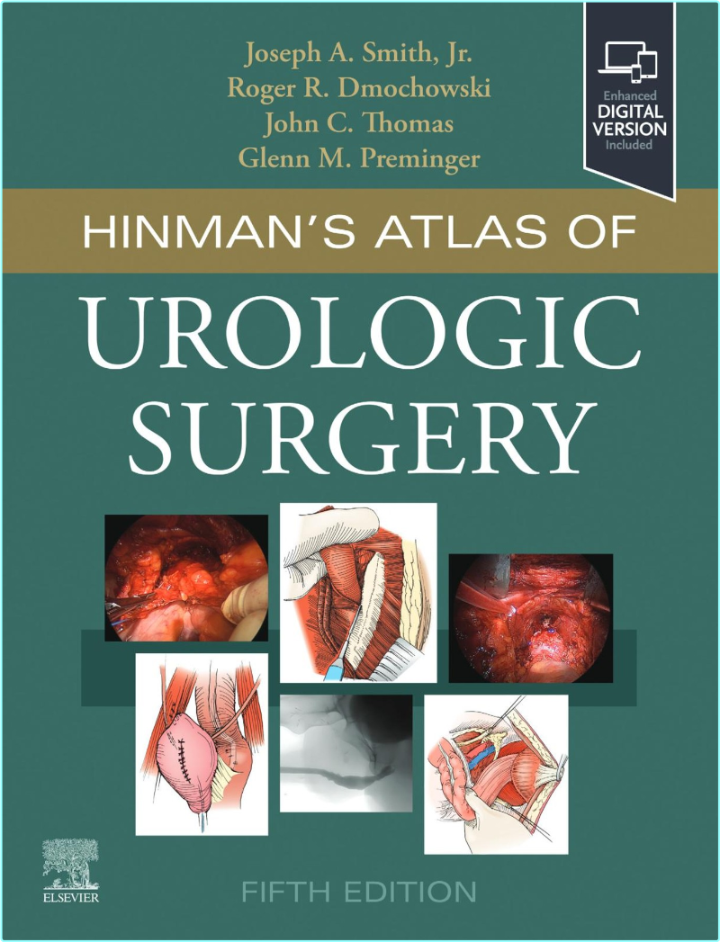 [Image: ME17VO3Y_o.png]