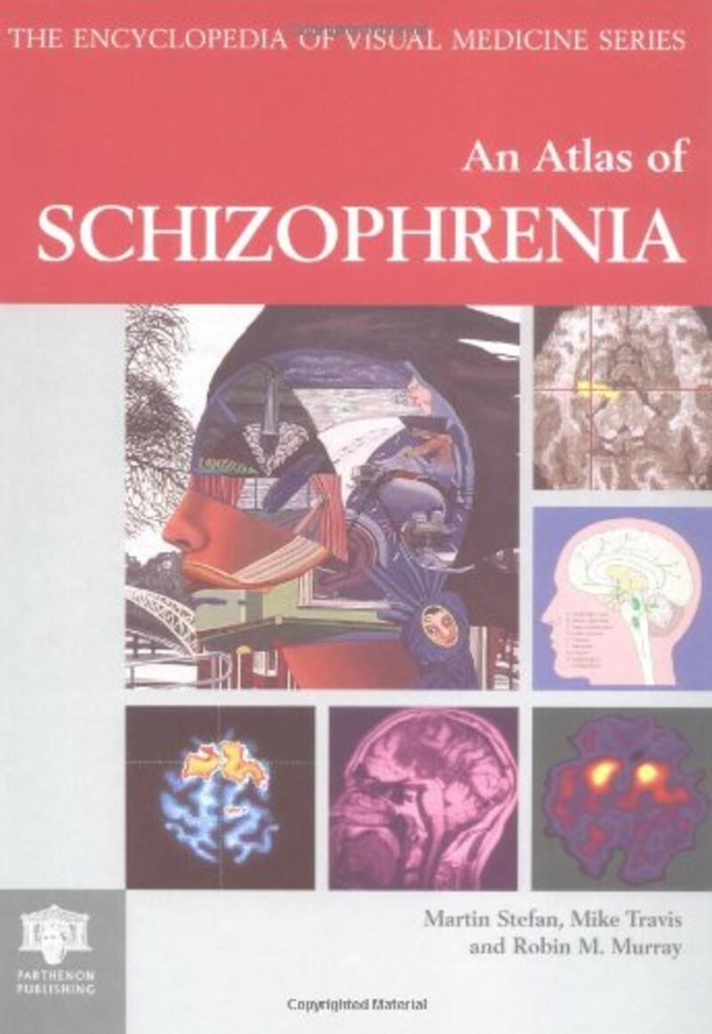 Atlas Of Schizophrenia Encyclopedia Of Visual Medicine Series (Murray, Robin)