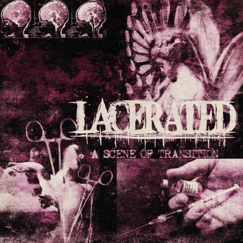  Lacerated - A Scene Of Transition (2026) 