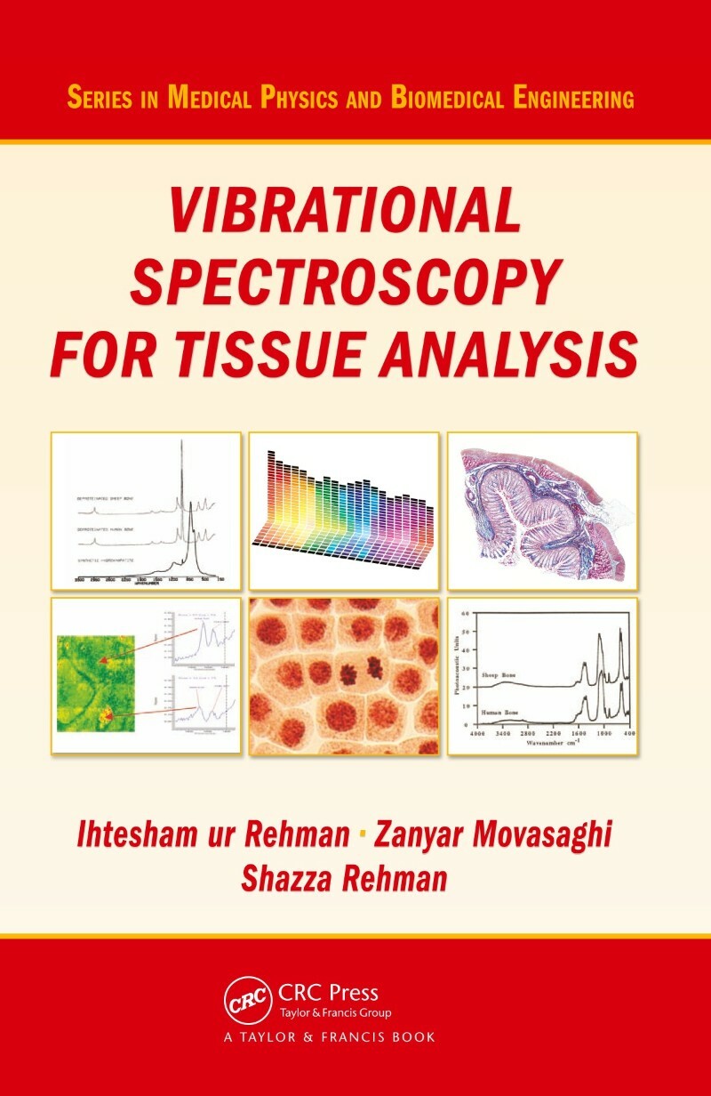 Vibrational Spectroscopy For Tissue Analysis (Rehman, Ihtesham ur.,Rehman, Shazza.,Movasaghi, Zanyar.) Vibrational Spectroscopy For Tissue Analysis (Rehman, Ihtesham ur.,Rehman, Shazza.,Movasaghi, Zanyar.)
