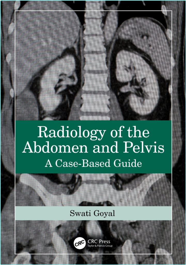 [Image: ME16OC3L_o.png]