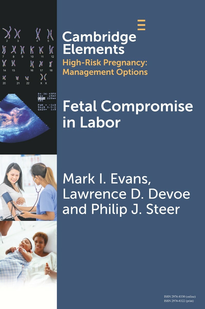 [Image: ME196RUF_o.jpg]