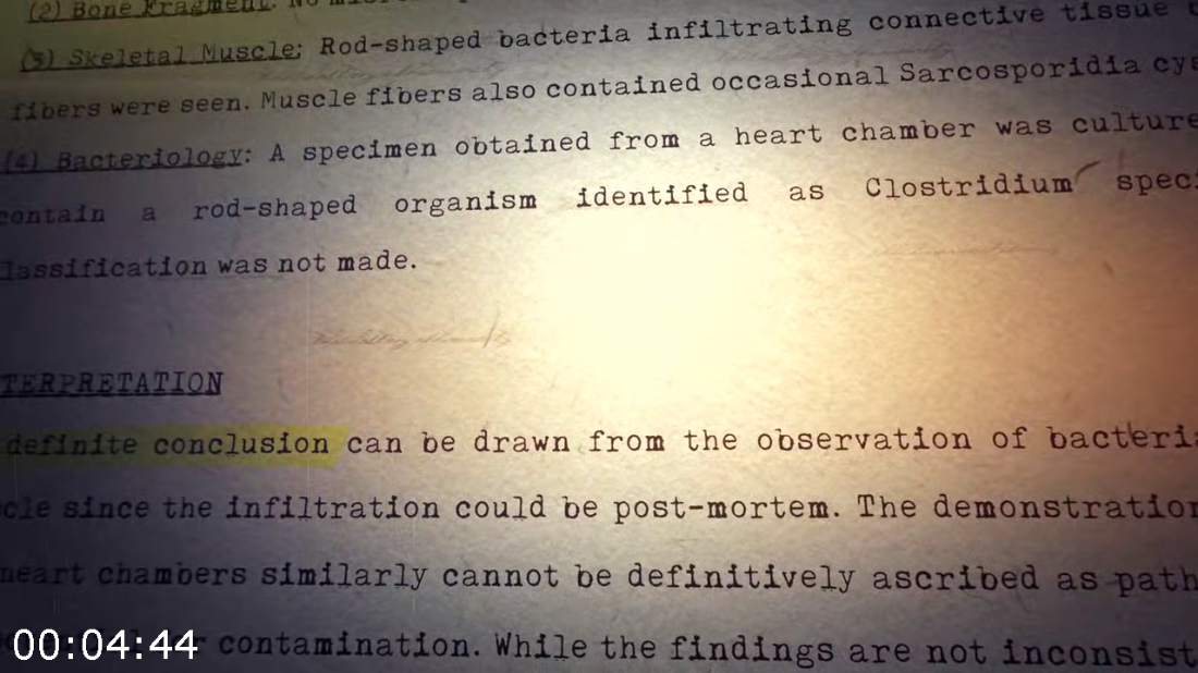 [Image: ME1923TX_o.png]