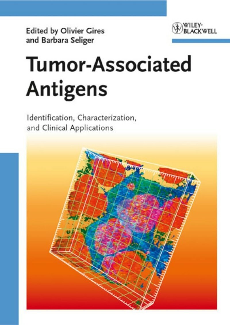 Tumor Associated Antigens Identification Characterization And Clinical Applications